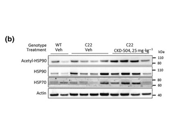 Western Blot using HSP90 K294ac